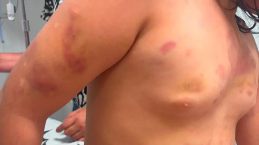 Padrasto preso após agredir menina autista de 6 anos