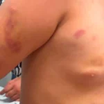 Padrasto preso após agredir menina autista de 6 anos