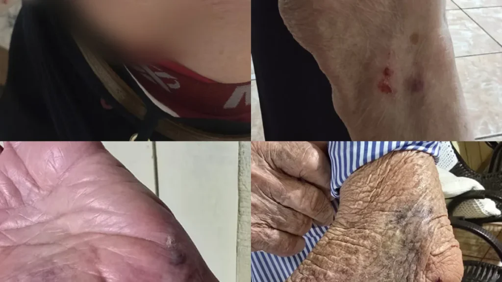 Idoso de 87 anos é atacado por cão ao ir ao mercado na Vila Nasser