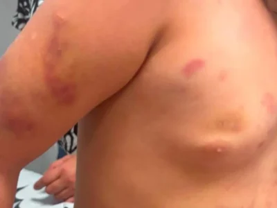 Mãe de menina autista agredida defende padrasto em áudio